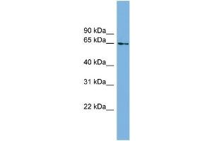 Human Heart; WB Suggested Anti-C8orf45 Antibody Titration: 0. (C8orf45 antibody  (Middle Region))