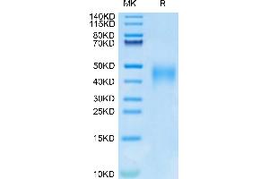 IL-9 Protein (AA 19-144) (His tag)