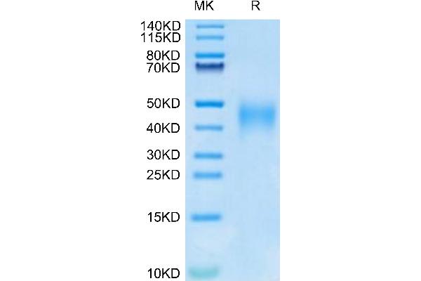 IL-9 Protein (AA 19-144) (His tag)