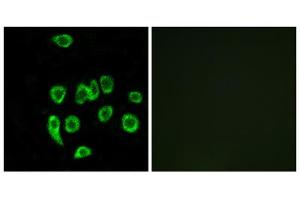 Immunofluorescence analysis of A549 cells, using MRPL32 antibody. (MRPL32 antibody  (Internal Region))