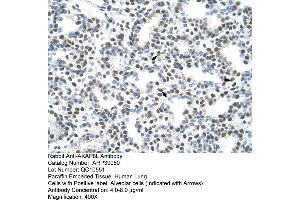 Human Lung (AKAP8L antibody  (C-Term))