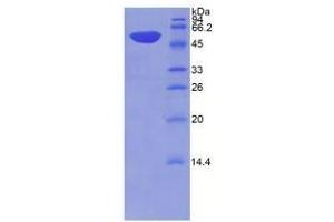 SDS-PAGE analysis of Rat THBS2 Protein.