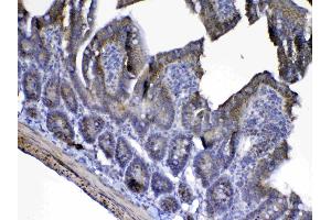 IHC analysis of Cytochrome C using anti-Cytochrome C antibody . (Cytochrome C antibody  (AA 2-105))