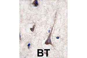 Formalin-fixed and paraffin-embedded human brain tissue reacted with CD3G polyclonal antibody  , which was peroxidase-conjugated to the secondary antibody, followed by DAB staining. (CD3G antibody  (N-Term))