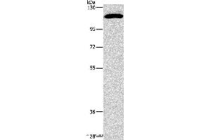 Western blot analysis of PC3 cell, using STAT2 Polyclonal Antibody at dilution of 1:800 (STAT2 antibody)