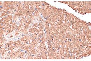 Immunohistochemistry (Paraffin-embedded Sections) (IHC (p)) image for anti-FERM Domain Containing 6 (FRMD6) antibody (ABIN7265006)