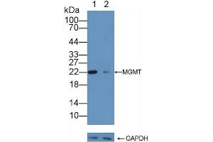 Western Blotting (WB) image for anti-O6-Methylguanine-DNA-Methyltransferase (MGMT) (AA 1-207) antibody (ABIN7434551)