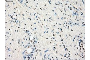 Immunohistochemical staining of paraffin-embedded endometrium tissue using anti-LTA4Hmouse monoclonal antibody. (LTA4H antibody)