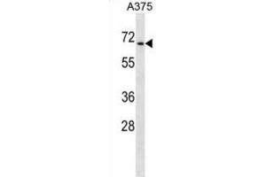 Western Blotting (WB) image for anti-Chromodomain Protein, Y-Like (CDYL) antibody (ABIN2998873) (CDYL antibody)