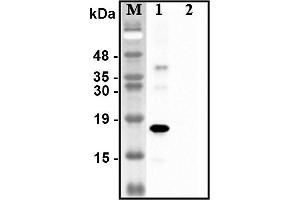 Western blot analysis of recombinant human CTRPs using anti-CTRP1 (human), pAb  at 1:4,000 dilution. (C1QTNF1 antibody)