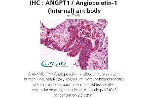 Image no. 1 for anti-Angiopoietin 1 (ANGPT1) (Internal Region) antibody (ABIN1731781) (Angiopoietin 1 antibody  (Internal Region))