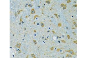 Immunohistochemistry (Paraffin-embedded Sections) (IHC (p)) image for anti-Ribosomal Protein S7 (RPS7) antibody (ABIN7262639)