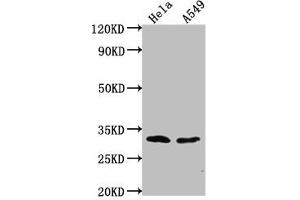 Western Blot Positive WB detected in: Hela whole cell lysate, A549 whole cell lysate All lanes: VAX2 antibody at 1:2000 Secondary Goat polyclonal to rabbit IgG at 1/50000 dilution Predicted band size: 31 kDa Observed band size: 31 kDa (VAX2 antibody  (AA 1-74))