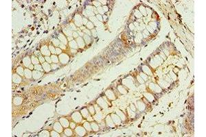 Immunohistochemistry of paraffin-embedded human colon tissue using ABIN7146811 at dilution of 1:100 (CEACAM8 antibody  (AA 35-320))