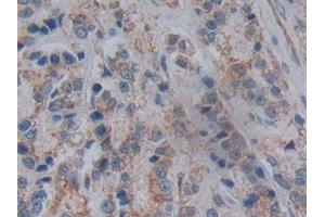 Immunohistochemistry (IHC) image for anti-5'-Nucleotidase, Cytosolic III (NT5C3) (AA 52-336) antibody (ABIN7442483)