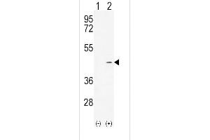 Western blot analysis of ADH4 (arrow) using rabbit polyclonal ADH4 Antibody (C-term) (ABIN654087 and ABIN2843975). (ADH4 antibody  (C-Term))