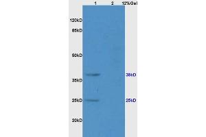 Lane 1: rat brain lysates Lane 2: rat liver lysates probed with Anti CD161 Polyclonal Antibody, Unconjugated (ABIN680998) at 1:200 in 4 °C. (CD161 antibody  (AA 151-225))