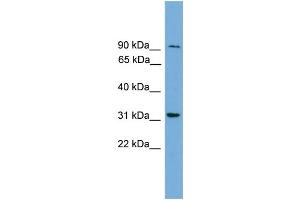 WB Suggested Anti-RP11-298P3. (RP11-298P3.3 (Middle Region) antibody)
