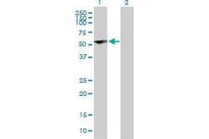 Western Blot analysis of ZNF232 expression in transfected 293T cell line by ZNF232 MaxPab polyclonal antibody. (ZNF232 antibody  (AA 1-444))