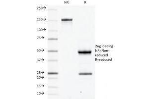 SDS-PAGE Analysis of Purified, BSA-Free CD79a Antibody (clone JCB117). (CD79a antibody  (AA 202-216))