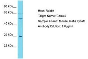 Image no. 1 for anti-Calcium/calmodulin-Dependent Protein Kinase IV (CAMK4) (AA 363-412) antibody (ABIN6750255) (CAMK4 antibody  (AA 363-412))