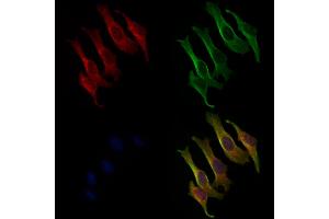 ABIN6263361 and ABIN6279016 staining 3 by IF/ICC.