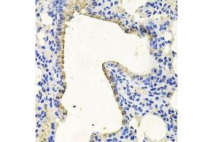 Immunohistochemistry (Paraffin-embedded Sections) (IHC (p)) image for anti-Protein Kinase N1 (PKN1) (AA 1-300) antibody (ABIN1682293)