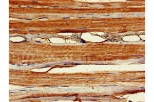 Immunohistochemistry of paraffin-embedded human skeletal muscle tissue using ABIN7160518 at dilution of 1:100 (MYF6 antibody  (AA 26-232))