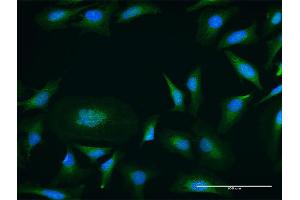 Immunofluorescence of purified MaxPab antibody to PRKD1 on HeLa cell. (PKC mu antibody  (AA 1-912))