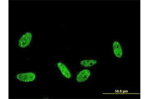 Immunofluorescence of monoclonal antibody to PRKRIP1 on HeLa cell. (PRKRIP1 antibody  (AA 1-184))