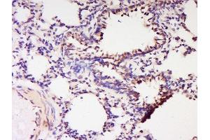 Formalin-fixed and paraffin embedded rat lung labeled with Anti-RNF56 Polyclonal Antibody, Unconjugated  at 1:200 followed by conjugation to the secondary antibody and DAB staining. (Cbl Proto-Oncogene B, E3 Ubiquitin Protein Ligase (CBLB) (AA 101-200) antibody)