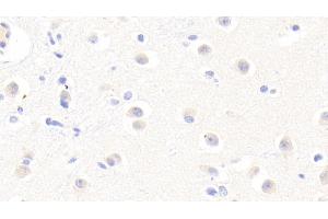 Detection of AFM in Human Cerebrum Tissue using Polyclonal Antibody to Afamin (AFM) (Afamin antibody  (AA 22-210))