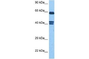Host:  Rabbit  Target Name:  FZD10  Sample Tissue:  Human MCF7 Whole Cell  Antibody Dilution:  1ug/ml (FZD10 antibody)