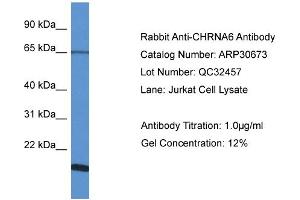 WB Suggested Anti-CHRNA6 Antibody   Titration: 1. (CHRNA6 antibody  (N-Term))
