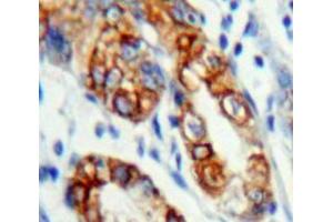 Used in DAB staining on fromalin fixed paraffin-embedded Stomach tissue (KLRC2 antibody  (AA 19-190))