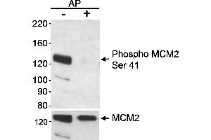 Western Blotting (WB) image for anti-Minichromosome Maintenance Complex Component 2 (MCM2) (pSer41) antibody (ABIN7449367)