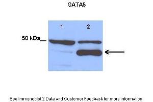 Lanes:   Lane 1: 25 ug empty vector transfected H460 cell lysate Lane 2: 25 ug hGATA5 transfected H460 cell lysate  Primary Antibody Dilution:   1:1200  Secondary Antibody:   Anti-rabbit HRP  Secondary Antibody Dilution:   1:3500  Gene Name:   GATA5  Submitted by:   Anonymous (GATA5 antibody  (Middle Region))