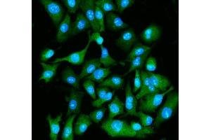 IF analysis of EIF5A using anti-EIF5A antibody (ABIN7599674). (EIF5A antibody  (AA 107-154))