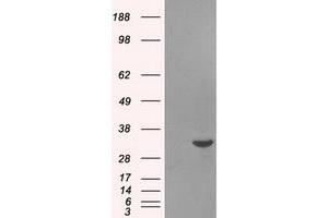 HEK293T cells were transfected with the pCMV6-ENTRY control (Left lane) or pCMV6-ENTRY BIRC7 (Right lane) cDNA for 48 hrs and lysed.