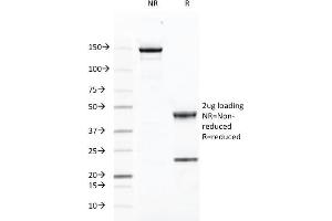 SDS-PAGE Analysis Purified CD46 Mouse Monoclonal Antibody (169-1-E4. (CD46 antibody)