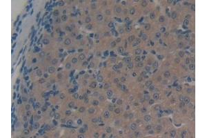 DAB staining on IHC-P; Samples: Mouse Ovary Tissue (ABCC1 antibody  (AA 1219-1469))