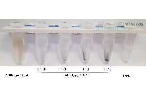 Cleavage Under Targets and Release Using Nuclease (CUT&RUN) image for Magnetic Concanavalin A Beads (Agarose) (ABIN6952467)