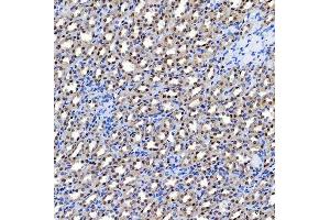 IHC analysis of SF3A1 using anti-SF3A1 antibody (ABIN7600556). (SF3A1 antibody  (AA 20-556))