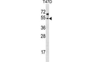 ZDHHC6 Antibody (C-term) western blot analysis in T47D cell line lysates (35 µg/lane). (ZDHHC6 antibody  (C-Term))