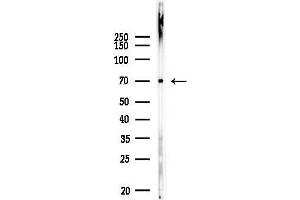 anti-EPM2A (Laforin) Interacting Protein 1 (EPM2AIP1) antibody