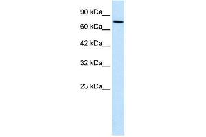 Human HepG2; WB Suggested Anti-WHSC1 Antibody Titration: 0. (WHSC1 antibody  (N-Term))