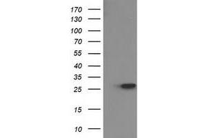HEK293T cells were transfected with the pCMV6-ENTRY control (Left lane) or pCMV6-ENTRY HPGD (Right lane) cDNA for 48 hrs and lysed. (HPGD antibody)