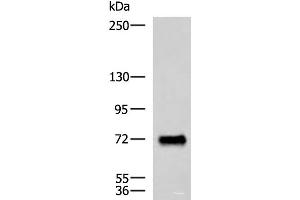 Western blot analysis of Human fetal brain tissue lysate using PPEF1 Polyclonal Antibody at dilution of 1:1500 (PPEF1 antibody)