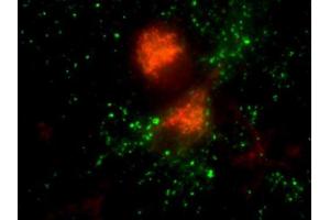 Immunofluorescence labeling of cultured hippocampal neurons with anti-vti1b (red; dilution 1 : 1000) and anti-synaptophysin (green; ; dilution 1 : 200).