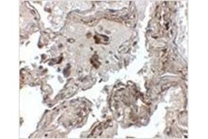 Immunohistochemistry of Transthyretin in human lung tissue with Transthyretin antibody at 2. (TTR antibody  (Center))